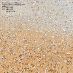 Recombinant Anti-Phospho-Tau(S202/T205) antibody (Rabbit mAb)