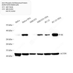 Anti-Phospho-S6 Ribosomal Protein (S240/S244) Rabbit pAb