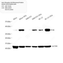 Anti-Phospho-S6 Ribosomal...