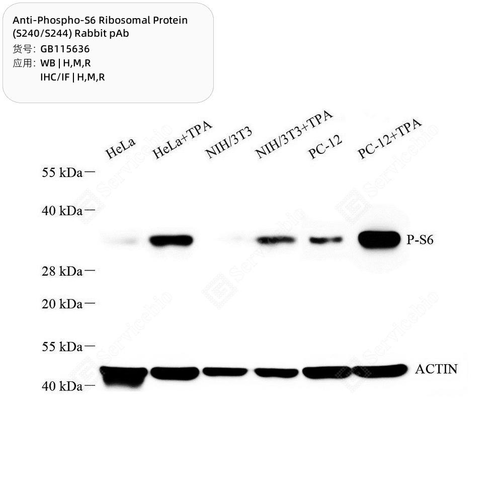 Anti-Phospho-S6 Ribosomal Protein (S240/S244) Rabbit pAb