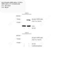 Anti-Phospho-AMPK alpha 1 (T183) + AMPK alpha 2 (T172) Rabbit pAb