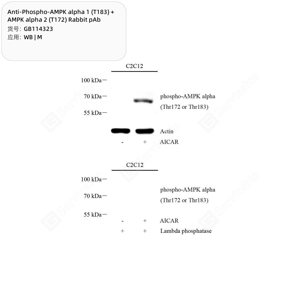 Anti-Phospho-AMPK alpha 1 (T183) + AMPK alpha 2 (T172) Rabbit pAb