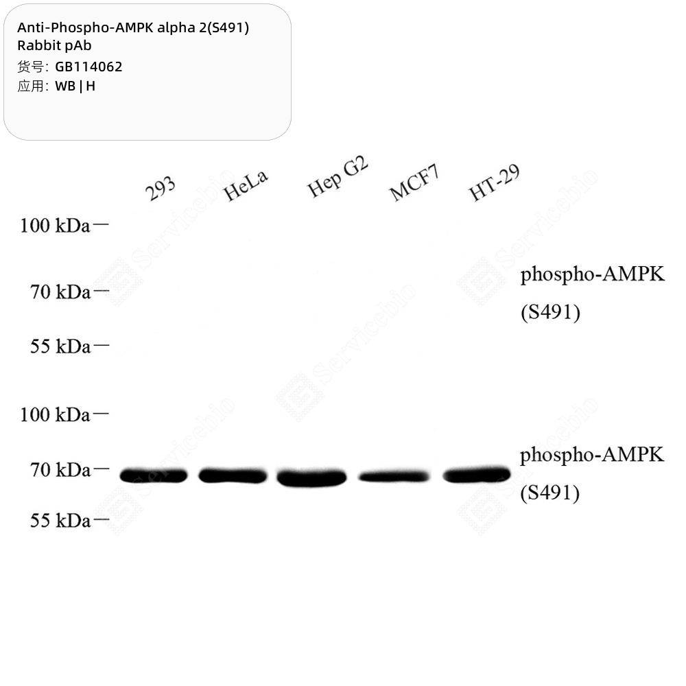 Anti-Phospho-AMPK alpha 2(S491) Rabbit pAb