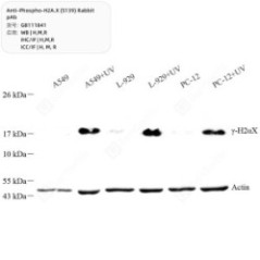 Anti-Phospho-H2A.X (S139)...