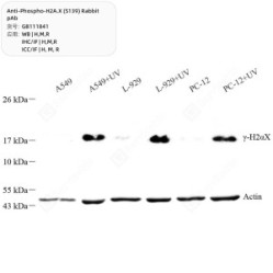 Anti-Phospho-H2A.X (S139) Rabbit pAb
