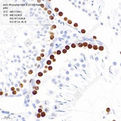 Anti-Phospho-H2A.X (S139) Rabbit pAb