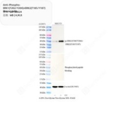 Anti-Phospho-ERK1(T202/Y204...