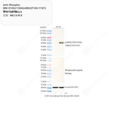Anti-Phospho-ERK1(T202/Y204)+ERK2(T185/Y187) Mouse mAb