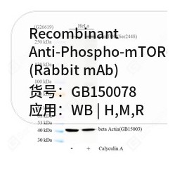 Recombinant Anti-Phospho-mTOR(S2448) antibody (Rabbit mAb)