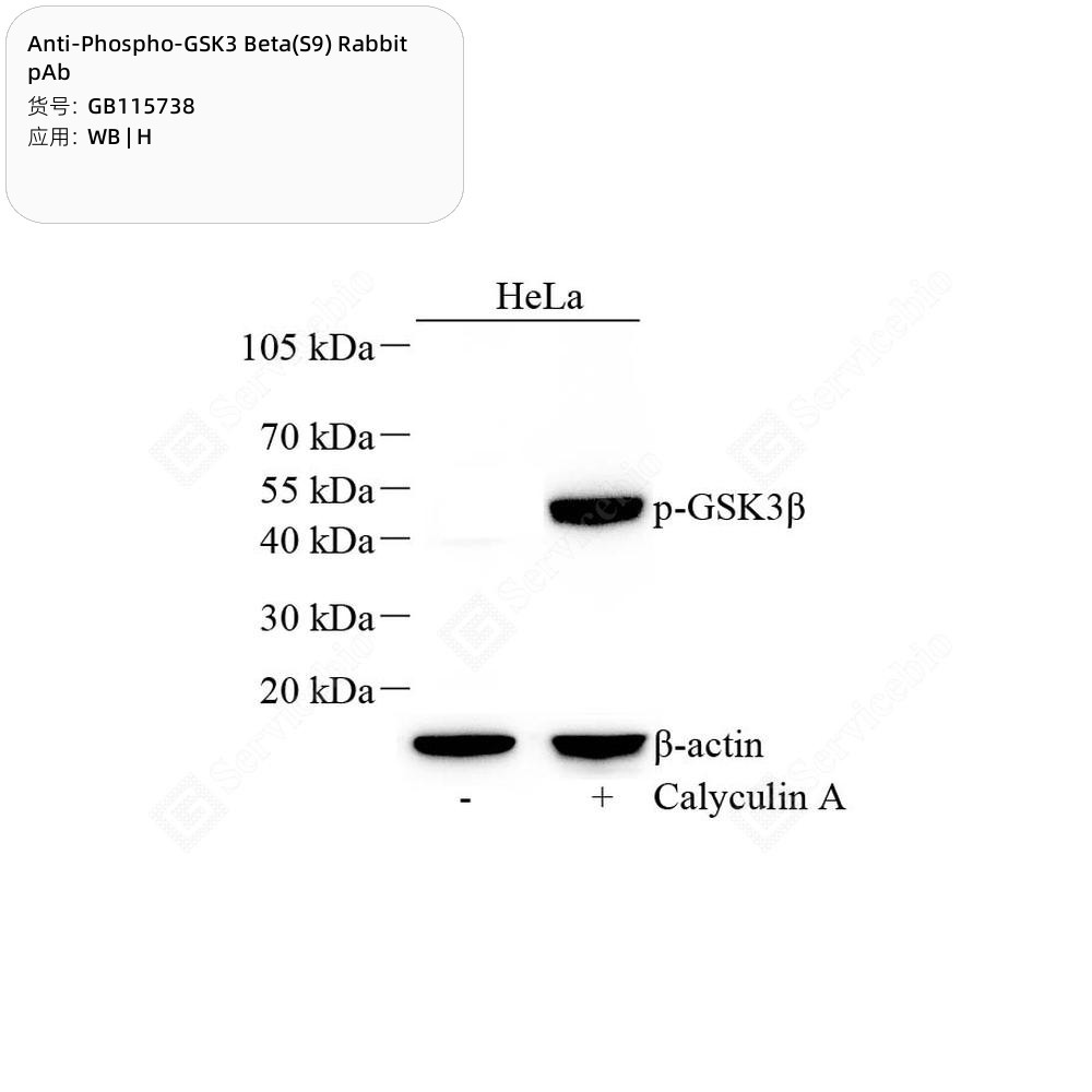 Anti-Phospho-GSK3 Beta(S9) Rabbit pAb