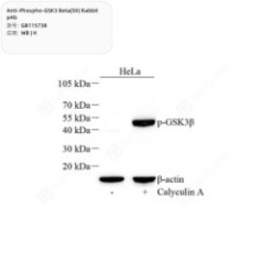 Anti-Phospho-GSK3 Beta(S9)...