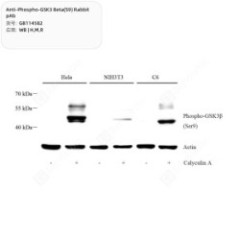 Anti-Phospho-GSK3 Beta(S9)...