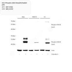 Anti-Phospho-GSK3 Beta(S9) Rabbit pAb