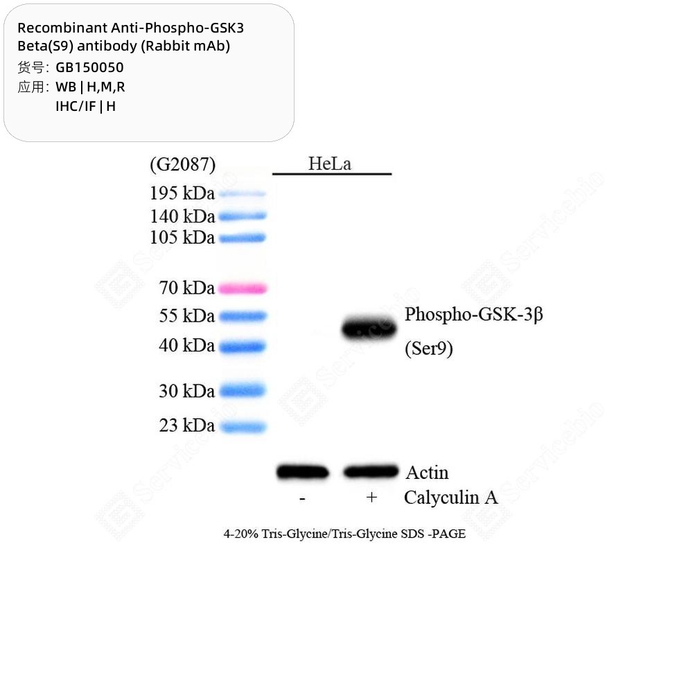 Recombinant Anti-Phospho-GSK3 Beta(S9) antibody (Rabbit mAb)