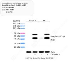 Recombinant Anti-Phospho-GSK3 Beta(S9) antibody (Rabbit mAb)