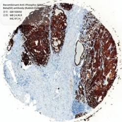 Recombinant Anti-Phospho-GSK3 Beta(S9) antibody (Rabbit mAb)