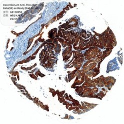 Recombinant Anti-Phospho-GSK3 Beta(S9) antibody (Rabbit mAb)