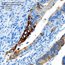Recombinant Anti-Phospho-GSK3 Beta(S9) antibody (Rabbit mAb)