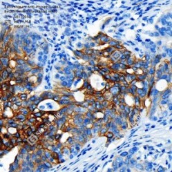Recombinant Anti-Phospho-GSK3 Beta(S9) antibody (Rabbit mAb)