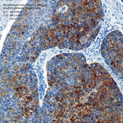 Recombinant Anti-Phospho-GSK3 Beta(S9) antibody (Rabbit mAb)
