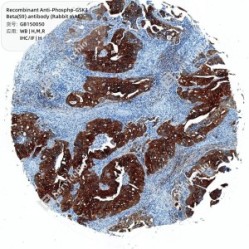 Recombinant Anti-Phospho-GSK3 Beta(S9) antibody (Rabbit mAb)