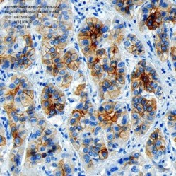 Recombinant Anti-Phospho-GSK3 Beta(S9) antibody (Rabbit mAb)