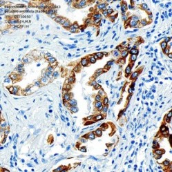 Recombinant Anti-Phospho-GSK3 Beta(S9) antibody (Rabbit mAb)