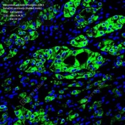 Recombinant Anti-Phospho-GSK3 Beta(S9) antibody (Rabbit mAb)