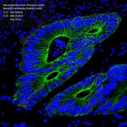Recombinant Anti-Phospho-GSK3 Beta(S9) antibody (Rabbit mAb)
