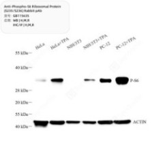 Anti-Phospho-S6 Ribosomal...