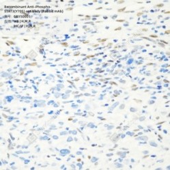 Recombinant Anti-Phospho-STAT3(Y705) antibody (Rabbit mAb)