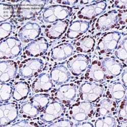 Recombinant Anti-Phospho-p38 (T180/Y182) antibody (Rabbit mAb)
