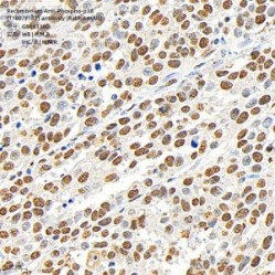 Recombinant Anti-Phospho-p38 (T180/Y182) antibody (Rabbit mAb)