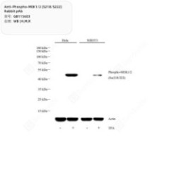 Anti-Phospho-MEK1/2...