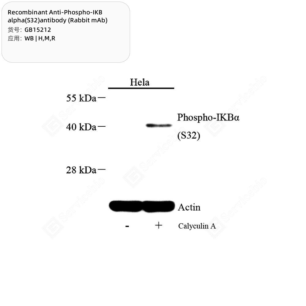 Recombinant Anti-Phospho-IKB alpha(S32)antibody (Rabbit mAb)
