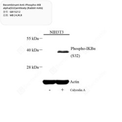 Recombinant Anti-Phospho-IKB alpha(S32)antibody (Rabbit mAb)