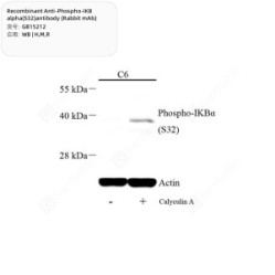 Recombinant Anti-Phospho-IKB alpha(S32)antibody (Rabbit mAb)