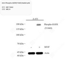 Anti-Phospho-EGFR(Y1069)...