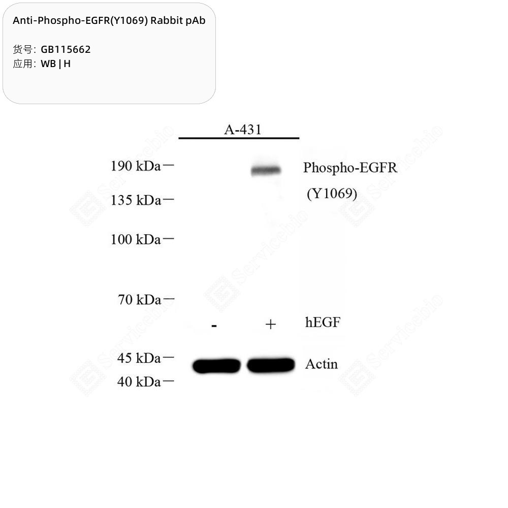 Anti-Phospho-EGFR(Y1069) Rabbit pAb