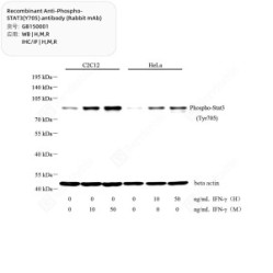 Recombinant Anti-Phospho-STAT3(Y705) antibody (Rabbit mAb)