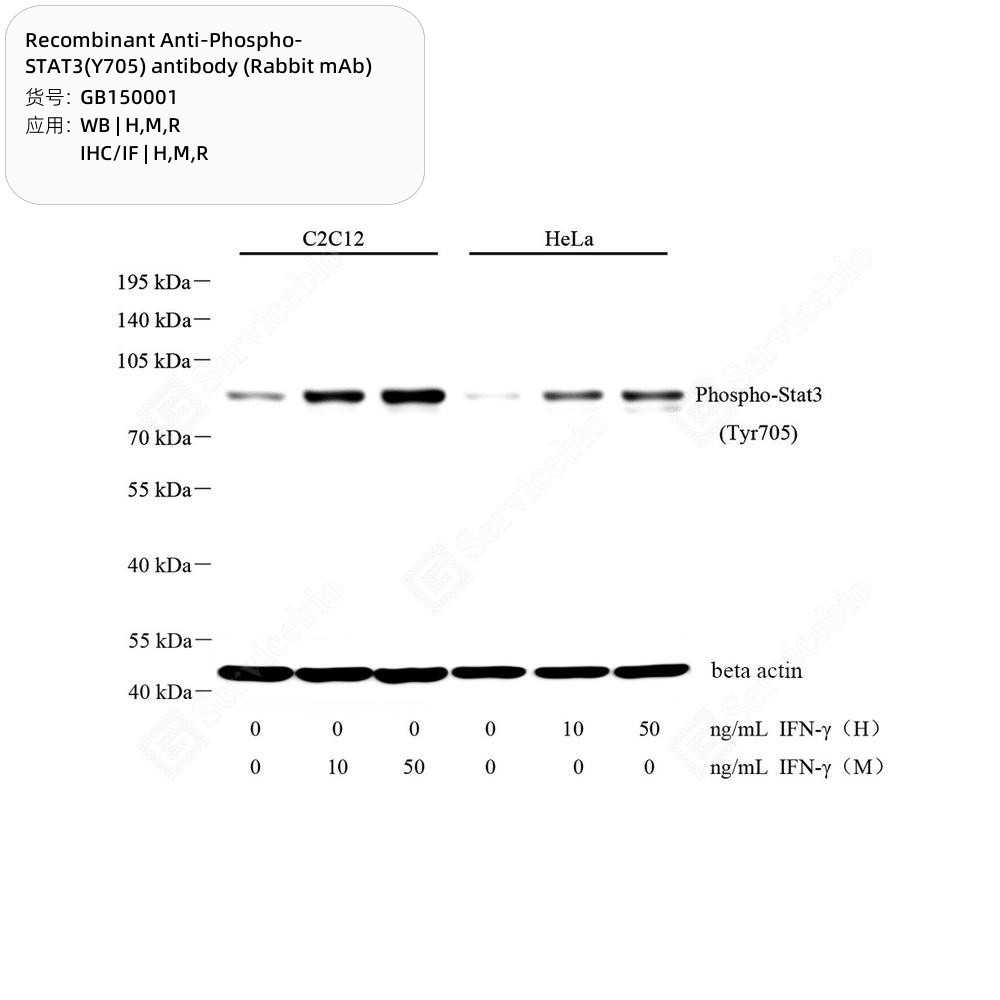 Recombinant Anti-Phospho-STAT3(Y705) antibody (Rabbit mAb)