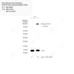 Recombinant Anti-Phospho-STAT3(Y705) antibody (Rabbit mAb)
