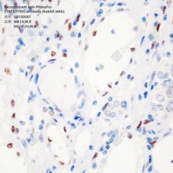Recombinant Anti-Phospho-STAT3(Y705) antibody (Rabbit mAb)
