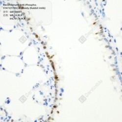 Recombinant Anti-Phospho-STAT3(Y705) antibody (Rabbit mAb)