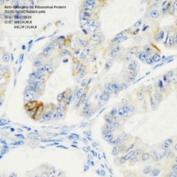Anti-Phospho-S6 Ribosomal Protein (S235/S236) Rabbit pAb