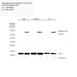 Recombinant Anti-Phospho-AKT (S473) antibody (Rabbit mAb)