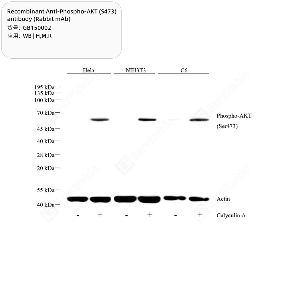 Recombinant Anti-Phospho-AKT (S473) antibody (Rabbit mAb)