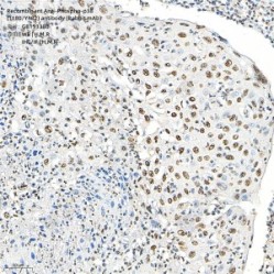Recombinant Anti-Phospho-p38 (T180/Y182) antibody (Rabbit mAb)