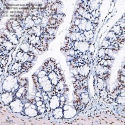 Recombinant Anti-Phospho-p38 (T180/Y182) antibody (Rabbit mAb)