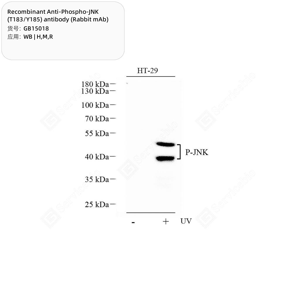 Recombinant Anti-Phospho-JNK (T183/Y185) antibody (Rabbit mAb)